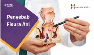 Read more about the article Penyebab Fisura Ani