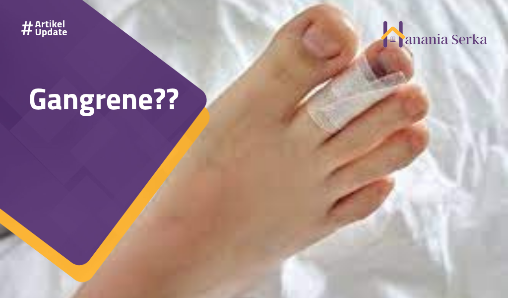 You are currently viewing Gangrene??