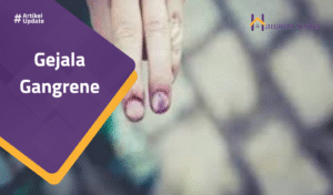 Read more about the article Gejala Gangrene
