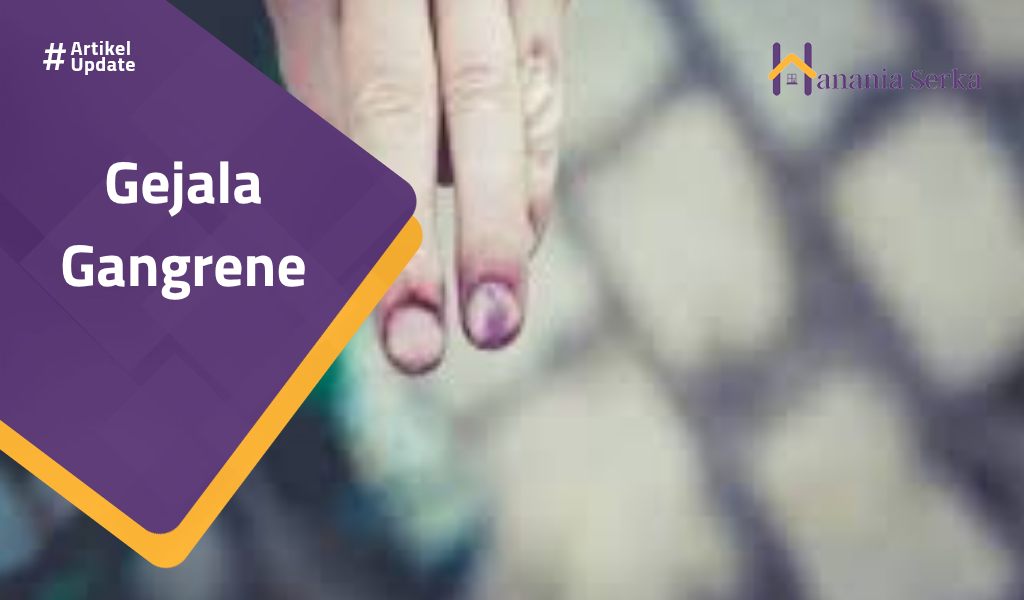 You are currently viewing Gejala Gangrene