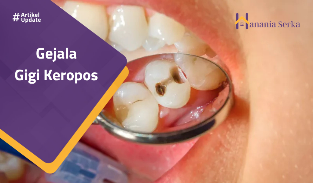 You are currently viewing Gejala Gigi Keropos