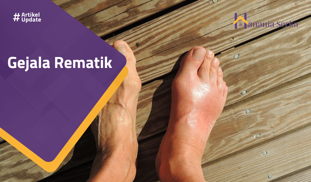 You are currently viewing Gejala Rematik