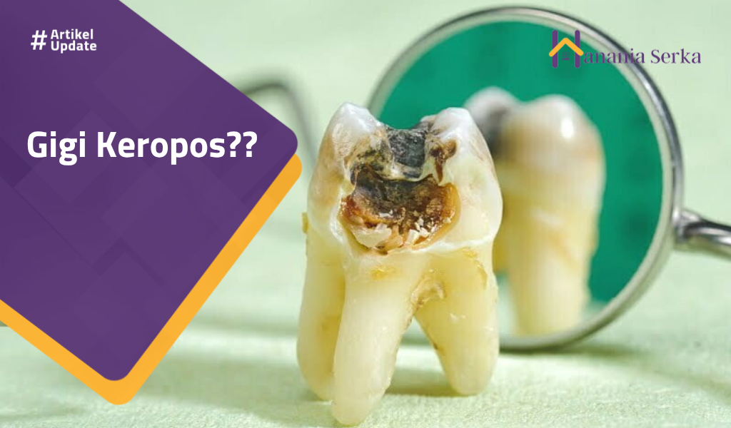 You are currently viewing Gigi Keropos??