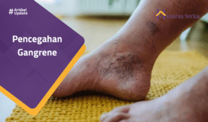 Read more about the article Pencegahan Gangrene