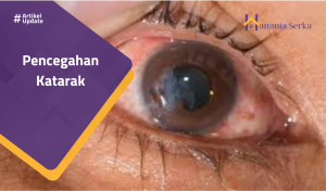 Read more about the article Pencegahan Katarak