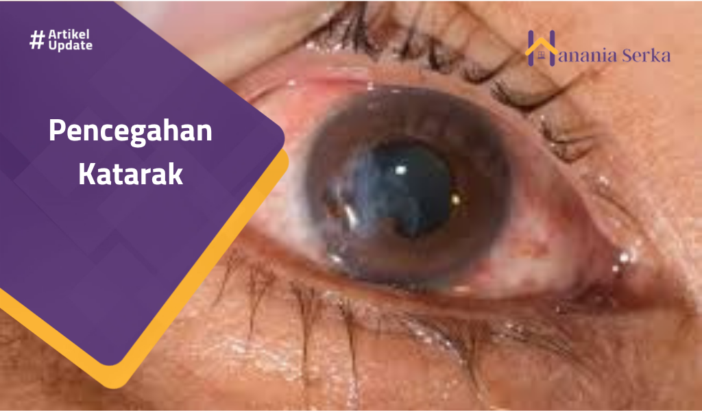 You are currently viewing Pencegahan Katarak