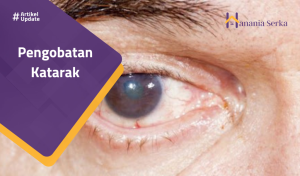 Read more about the article Pengobatan Katarak