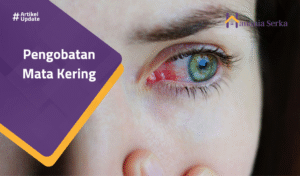 Read more about the article Pengobatan Mata Kering