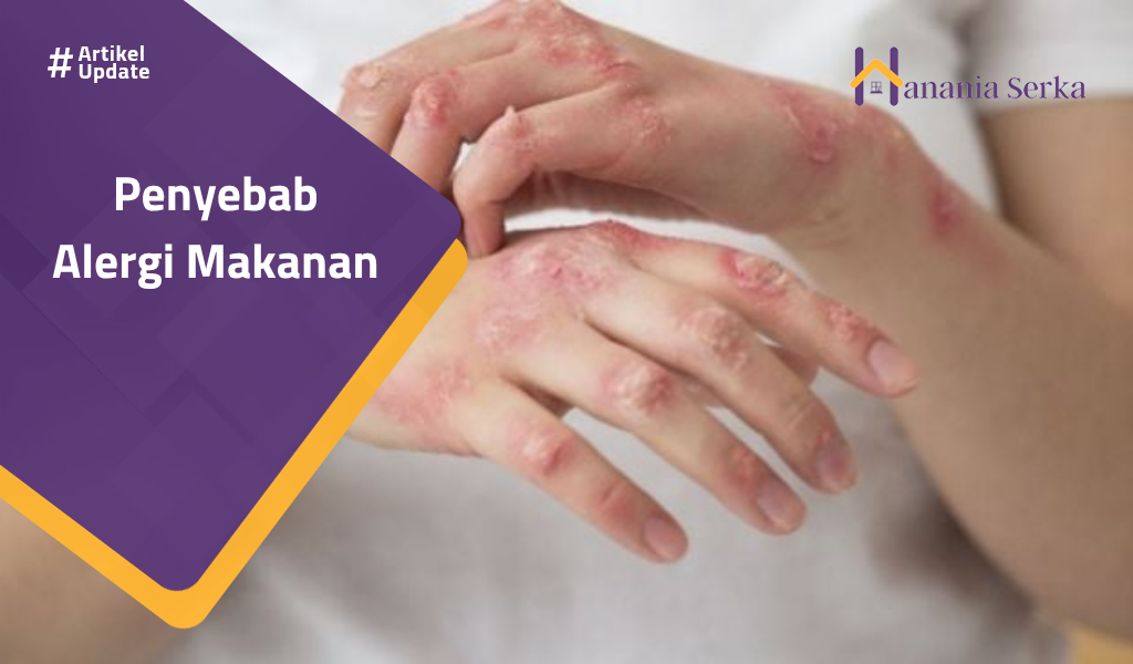 You are currently viewing Penyebab Alergi Makanan
