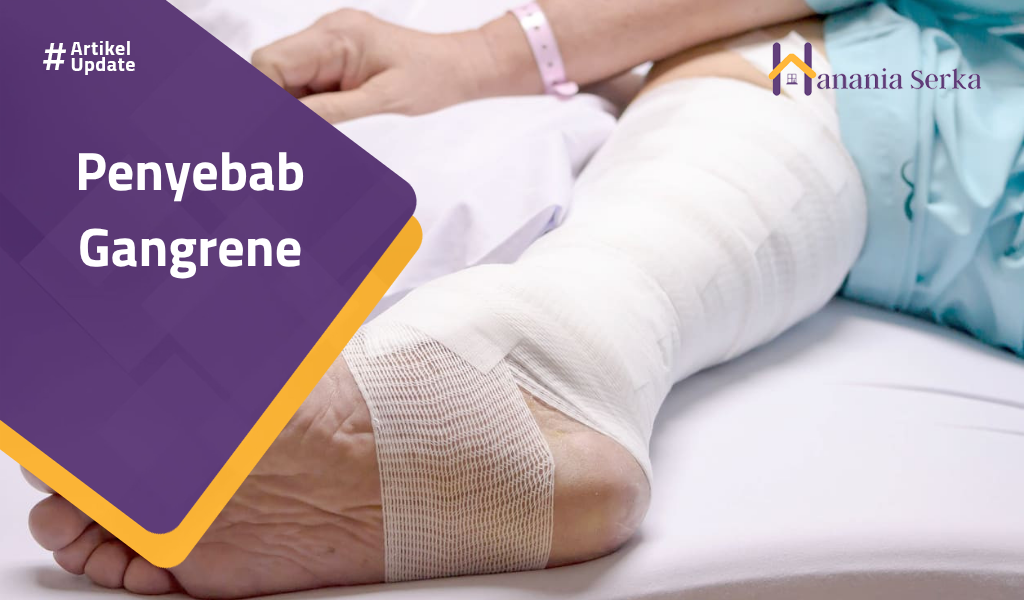 You are currently viewing Penyebab Gangrene