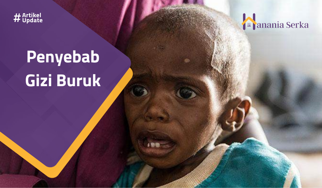 You are currently viewing Penyebab Gizi Buruk