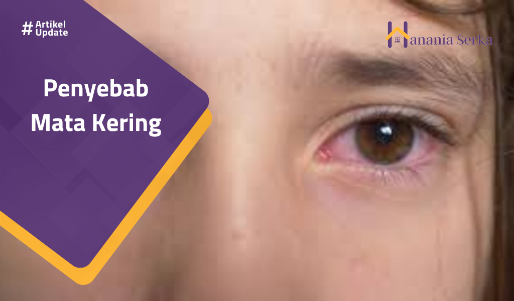 Read more about the article Penyebab Mata Kering