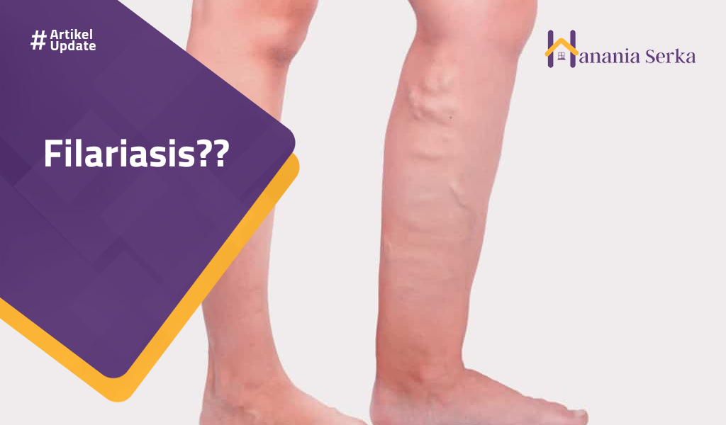Read more about the article Filariasis??