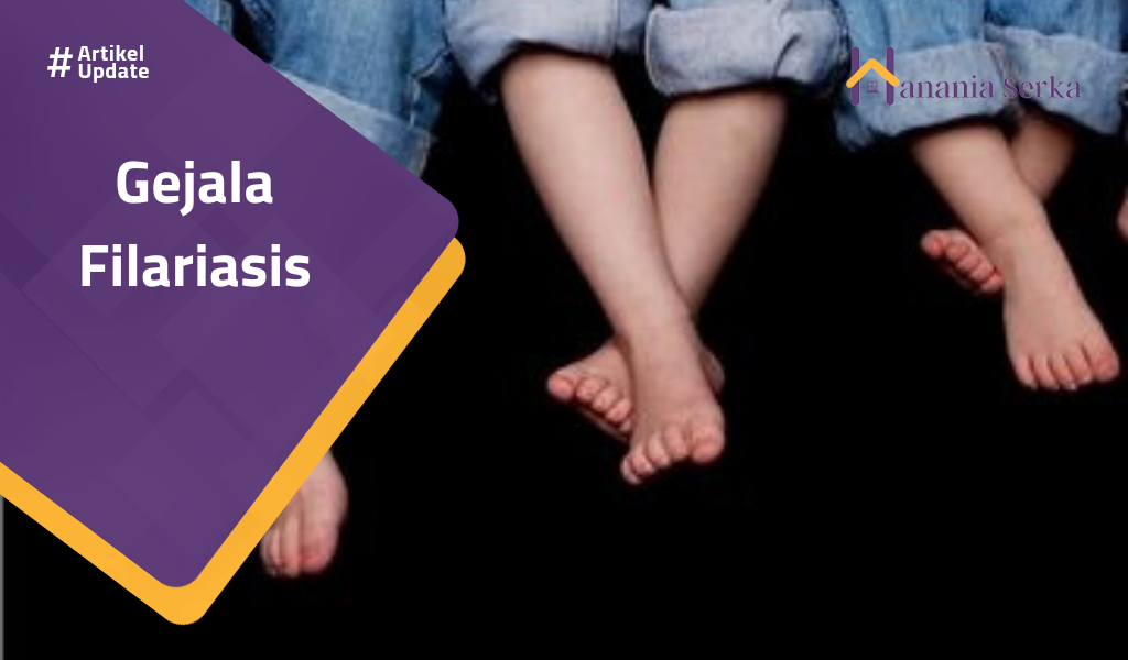 You are currently viewing Gejala Filariasis
