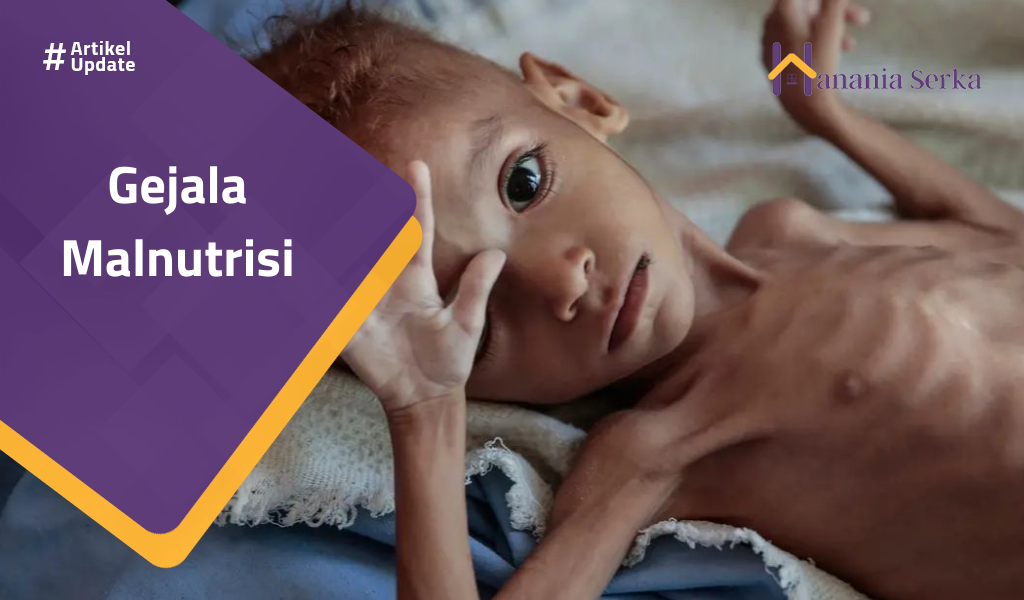 You are currently viewing Gejala Malnutrisi