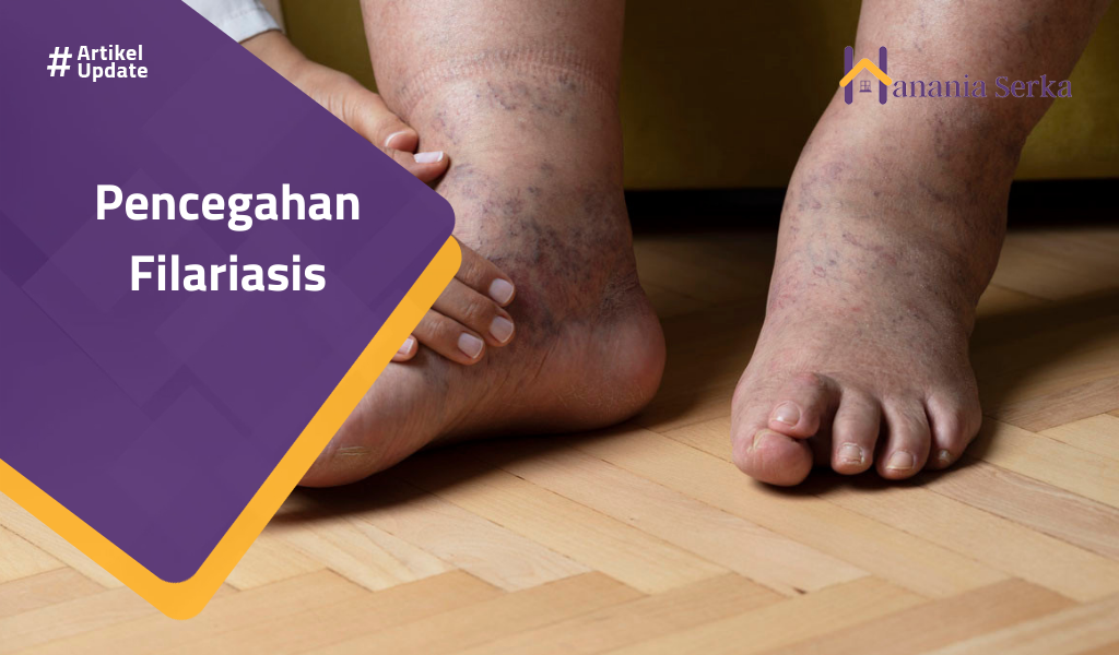Read more about the article Pencegahan Filariasis