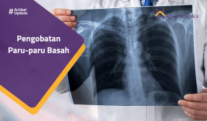 Read more about the article Pengobatan Paru-Paru Basah