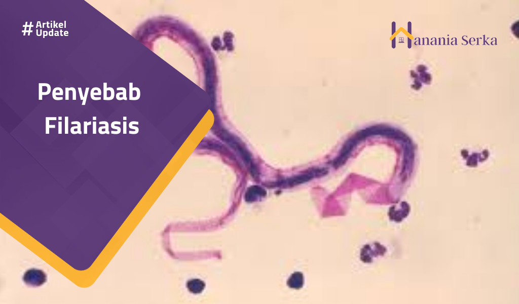 Read more about the article Penyebab Filariasis