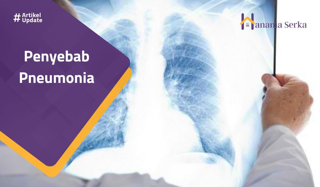 You are currently viewing Penyebab Pneumonia