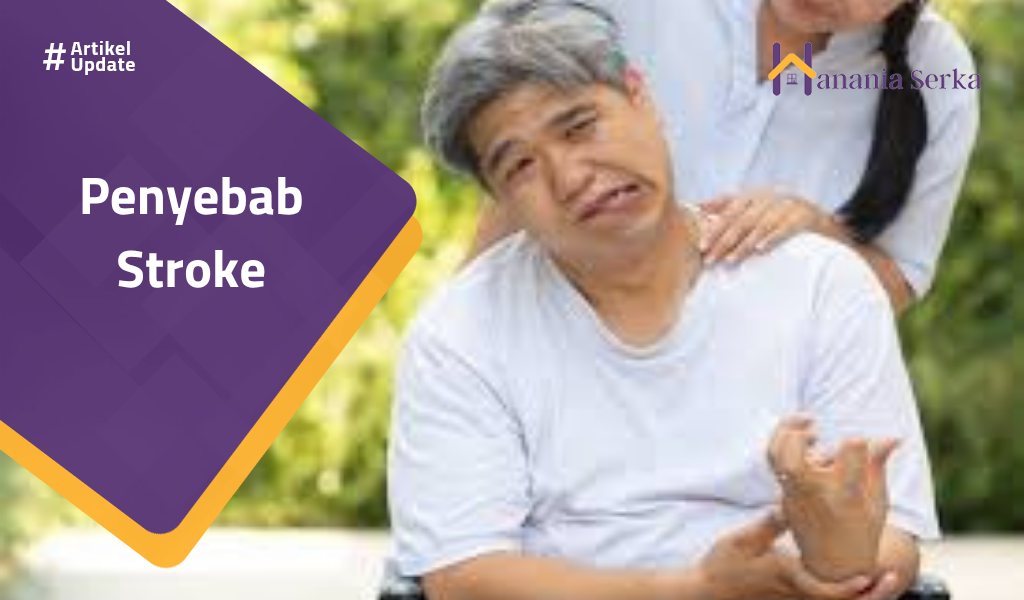 Read more about the article Penyebab Stroke