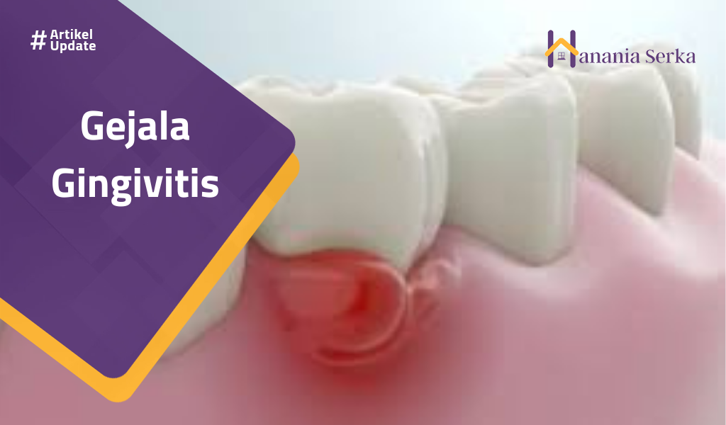 Read more about the article Gejala Gingivitis