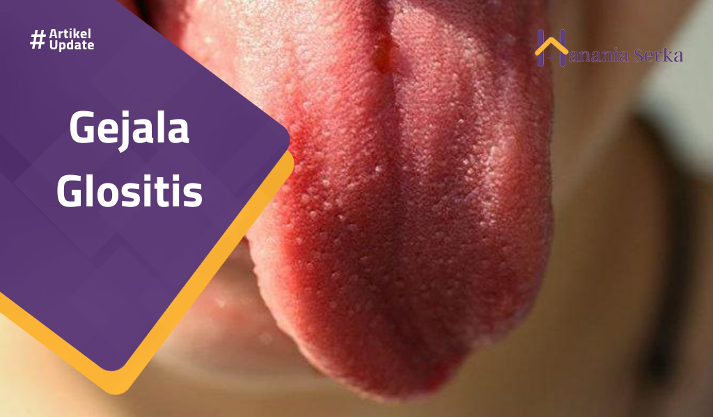You are currently viewing Gejala Glositis