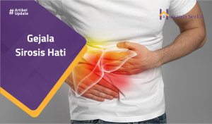 Read more about the article Gejala Sirosis Hati