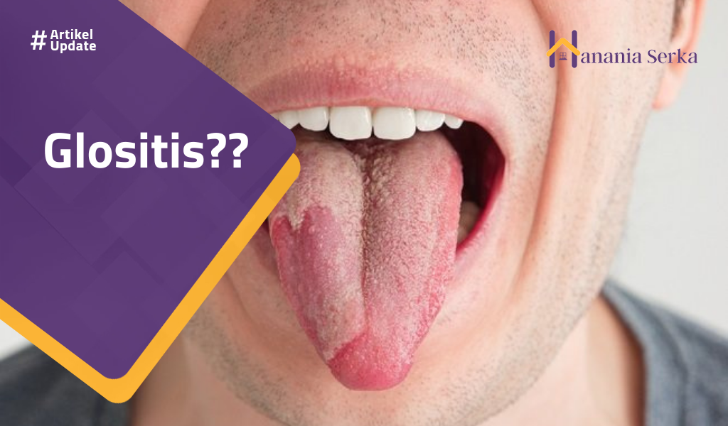 You are currently viewing Glositis??