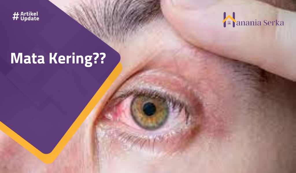 You are currently viewing Mata Kering??