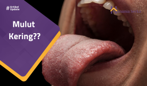 Read more about the article Mulut Kering??