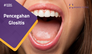 Read more about the article Pencegahan Glositis