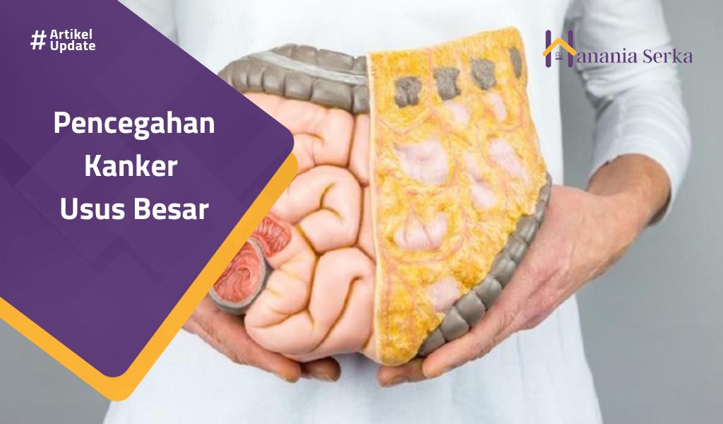 You are currently viewing Pencegahan Kanker Usus Besar