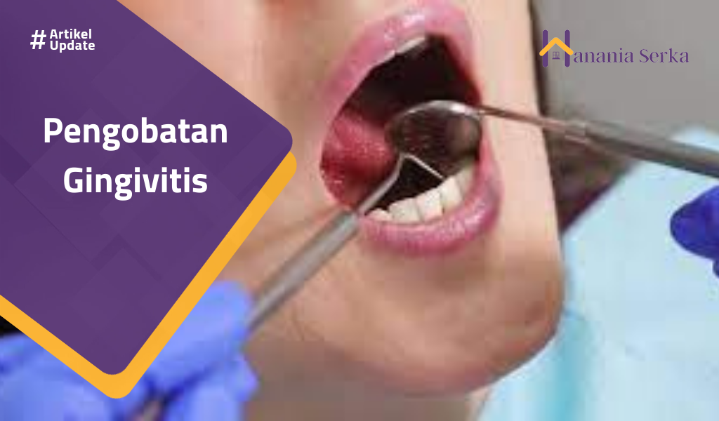 You are currently viewing Pengobatan Gingivitis