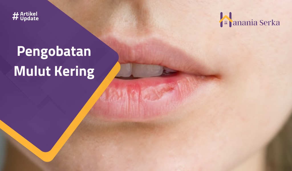 Read more about the article Pengobatan Mulut Kering