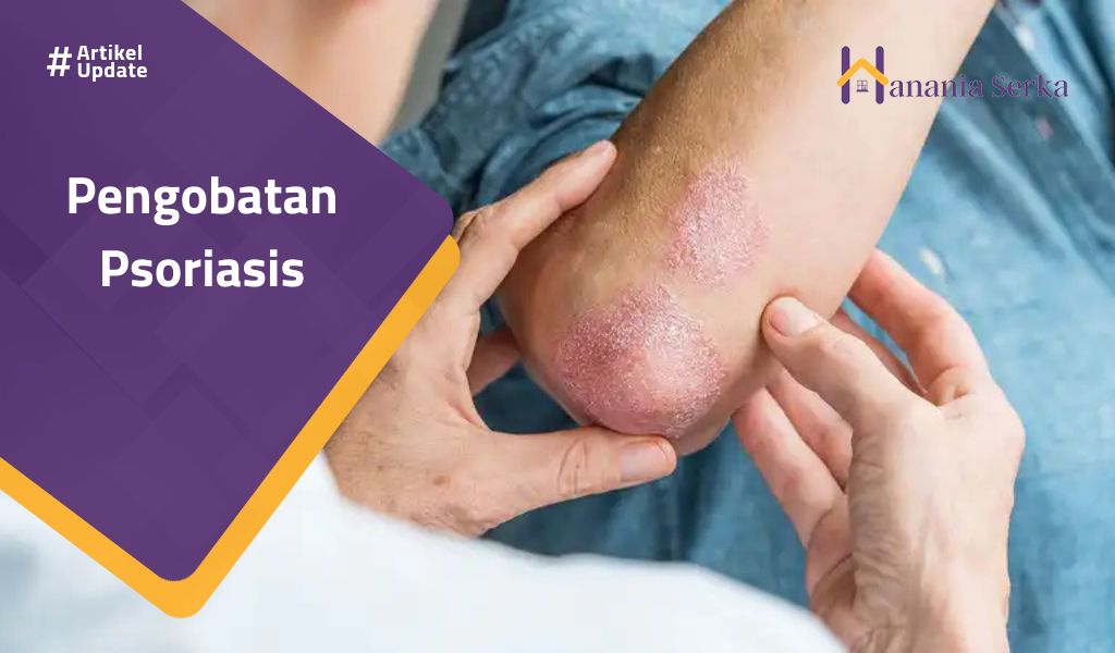 Read more about the article Pengobatan Psoriasis