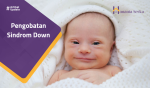 Read more about the article Pengobatan Sindrom Down