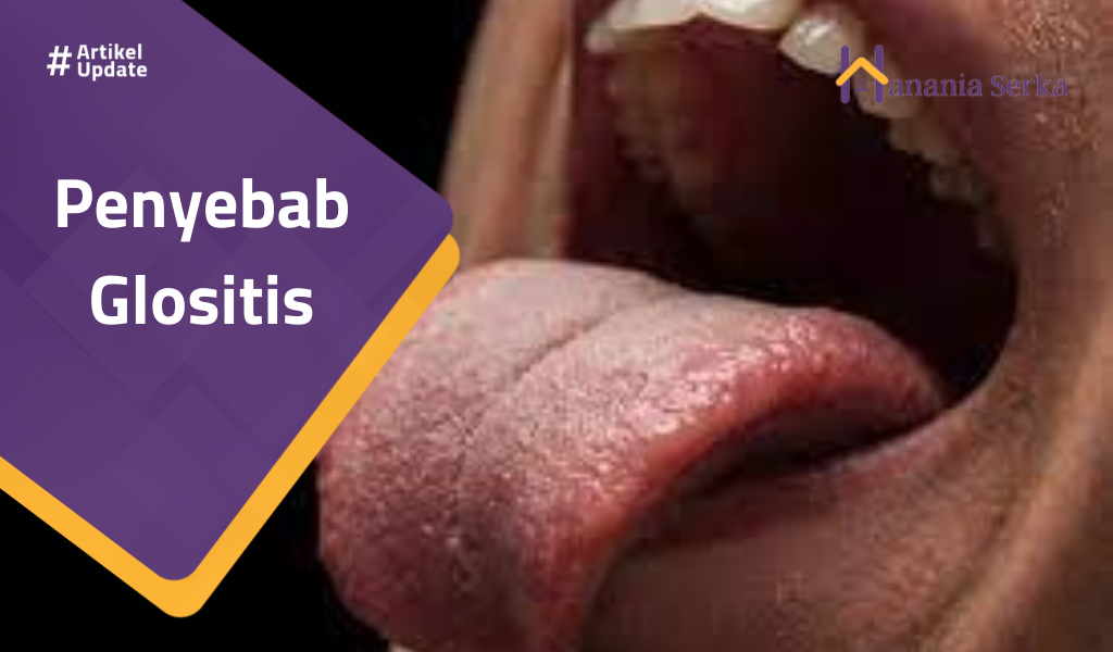 You are currently viewing Penyebab Glositis