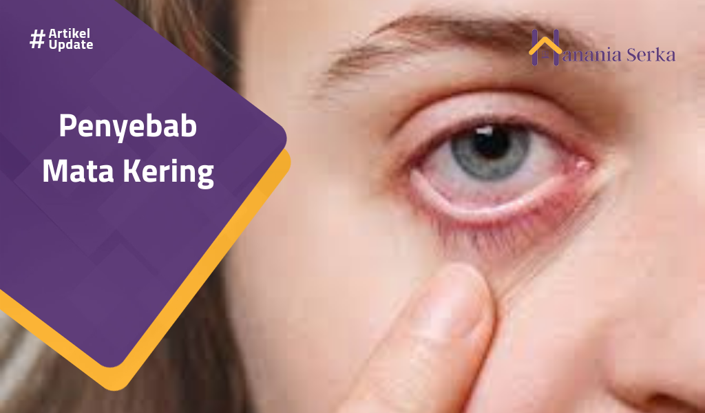 Read more about the article Penyebab Mata Kering