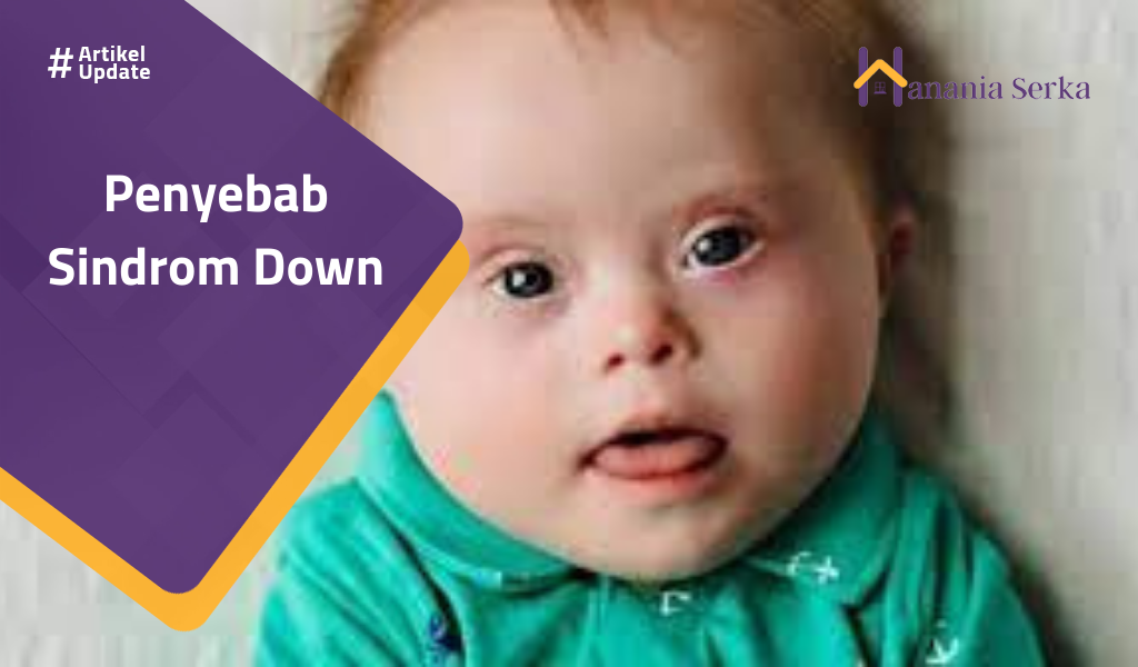 Read more about the article Penyebab Sindrom Down