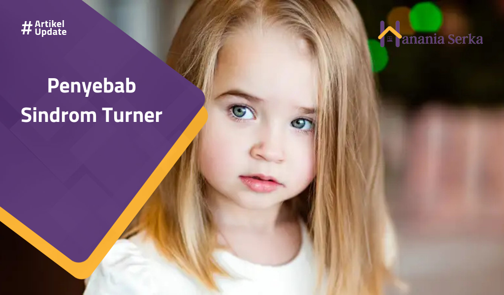 You are currently viewing Penyebab Sindrom Turner
