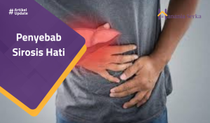 Read more about the article Penyebab Sirosis Hati