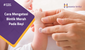 Read more about the article Cara Mengatasi Bintik Merah Pada Bayi