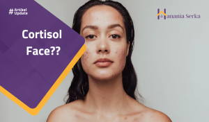 Read more about the article Cortisol Face??