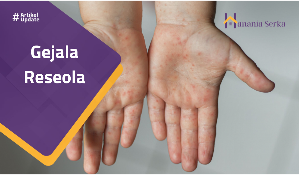 You are currently viewing Gejala Roseola
