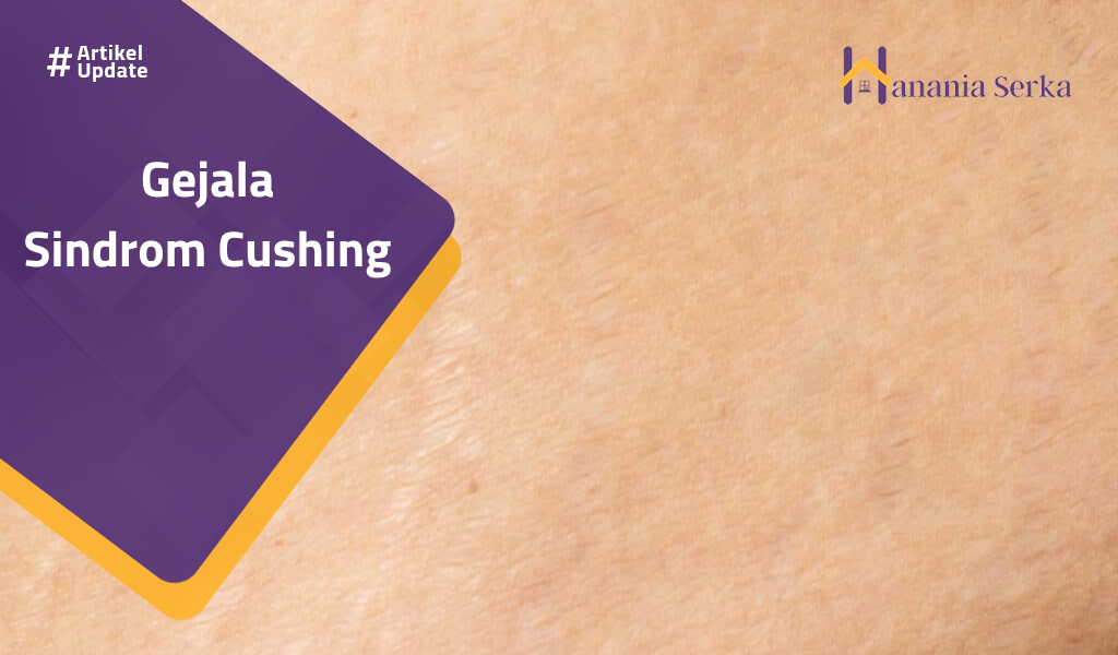 You are currently viewing Gejala Sindrom Cushing