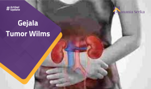 Read more about the article Gejala Tumor Wilms