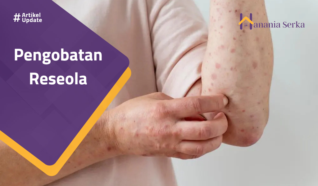 Read more about the article Pengobatan Roseola