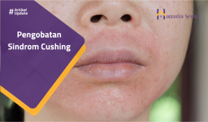 Read more about the article Pengobatan Sindrom Cushing