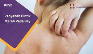 Read more about the article Penyebab Bintik Merah Pada Bayi