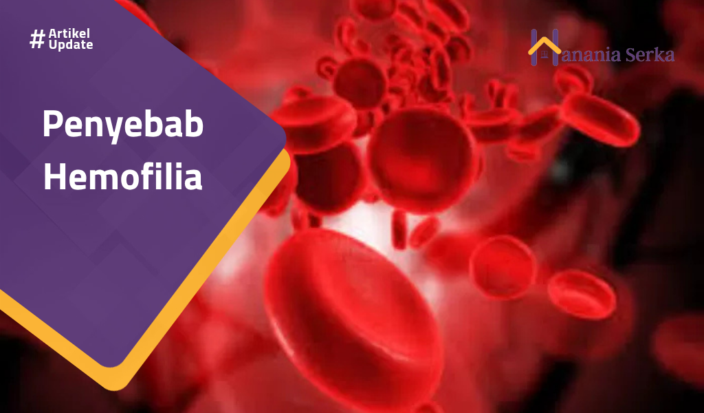 You are currently viewing Penyebab Hemofilia